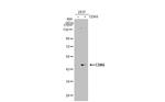 CDK6 Antibody in Western Blot (WB)