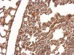 CRMP1 Antibody in Immunohistochemistry (Paraffin) (IHC (P))