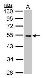 CSK Antibody in Western Blot (WB)