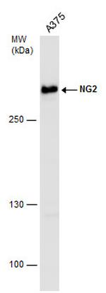 NG2 Antibody in Western Blot (WB)