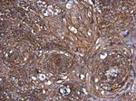 beta Catenin Antibody in Immunohistochemistry (Paraffin) (IHC (P))