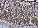 beta Catenin Antibody in Immunohistochemistry (Paraffin) (IHC (P))