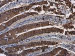 beta Catenin Antibody in Immunohistochemistry (Paraffin) (IHC (P))