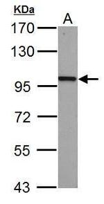 beta Catenin Antibody in Western Blot (WB)