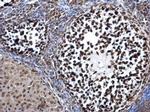 DNMT3A Antibody in Immunohistochemistry (Paraffin) (IHC (P))