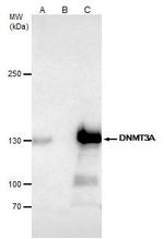 DNMT3A Antibody in Immunoprecipitation (IP)