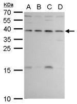 ERCC1 Antibody in Western Blot (WB)