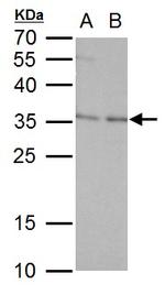 ERCC1 Antibody in Western Blot (WB)