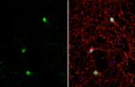 ETV1 Antibody in Immunocytochemistry (ICC/IF)