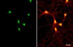 ETV1 Antibody in Immunocytochemistry (ICC/IF)