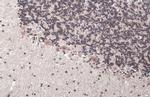 ETV1 Antibody in Immunohistochemistry (Paraffin) (IHC (P))