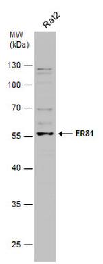 ETV1 Antibody in Western Blot (WB)