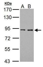 Prothrombin Antibody in Western Blot (WB)