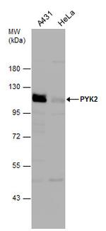 PYK2 Antibody in Western Blot (WB)