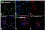 GFI1 Antibody in Immunocytochemistry (ICC/IF)