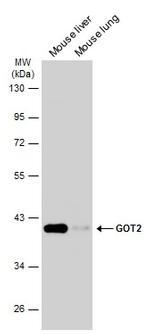 GOT2 Antibody in Western Blot (WB)