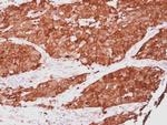 HSP27 Antibody in Immunohistochemistry (Paraffin) (IHC (P))