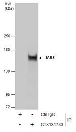 IARS Antibody in Immunoprecipitation (IP)