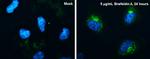 CYR61 Antibody in Immunocytochemistry (ICC/IF)