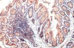 CYR61 Antibody in Immunohistochemistry (Paraffin) (IHC (P))