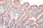 CYR61 Antibody in Immunohistochemistry (Paraffin) (IHC (P))