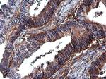 ITGB1 Antibody in Immunohistochemistry (Paraffin) (IHC (P))