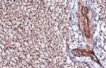 ITGB1 Antibody in Immunohistochemistry (Paraffin) (IHC (P))