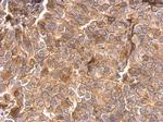 ITGB1 Antibody in Immunohistochemistry (Paraffin) (IHC (P))