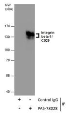 ITGB1 Antibody in Immunoprecipitation (IP)