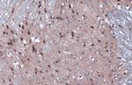 JARID2 Antibody in Immunohistochemistry (Paraffin) (IHC (P))