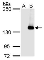 JARID2 Antibody in Western Blot (WB)