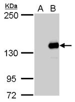 JARID2 Antibody in Western Blot (WB)