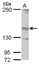 JARID2 Antibody in Western Blot (WB)