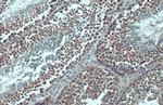 KPNB1 Antibody in Immunohistochemistry (Paraffin) (IHC (P))