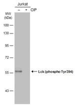 Phospho-LCK (Tyr394) Antibody in Western Blot (WB)