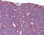 LCK Antibody in Immunohistochemistry (Paraffin) (IHC (P))