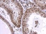 Lamin A/C Antibody in Immunohistochemistry (Paraffin) (IHC (P))