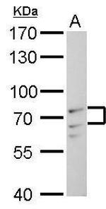 Lamin A/C Antibody in Western Blot (WB)