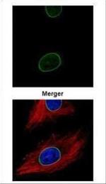 Lamin A/C Antibody in Immunocytochemistry (ICC/IF)