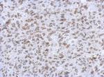 Lamin A/C Antibody in Immunohistochemistry (Paraffin) (IHC (P))