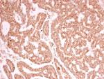 Lamin A/C Antibody in Immunohistochemistry (Paraffin) (IHC (P))