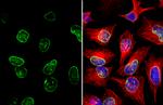 Lamin A/C Antibody in Immunocytochemistry (ICC/IF)