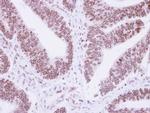 Lamin B1 Antibody in Immunohistochemistry (Paraffin) (IHC (P))