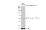 Phospho-Lyn (Tyr396) Antibody in Western Blot (WB)