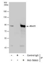 MRE11 Antibody in Immunoprecipitation (IP)