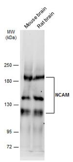 CD56 (NCAM) Antibody in Western Blot (WB)