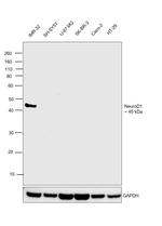 NeuroD1 Antibody in Western Blot (WB)