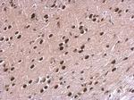 NPAS1 Antibody in Immunohistochemistry (Paraffin) (IHC (P))