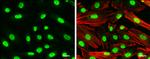 Nurr1 Antibody in Immunocytochemistry (ICC/IF)