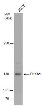 PHKA1 Antibody in Western Blot (WB)